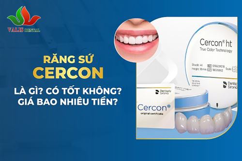 Bọc răng sứ Cercon – Cho hàm răng bền đẹp tự nhiên, chân thật