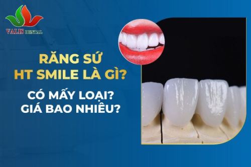 Răng sứ HT Smile – Khắc phục khuyết điểm, tôn tạo đẳng cấp