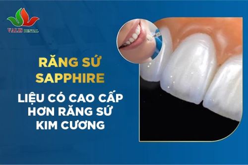 Răng sứ Sapphire liệu có cao cấp hơn răng sứ kim cương?