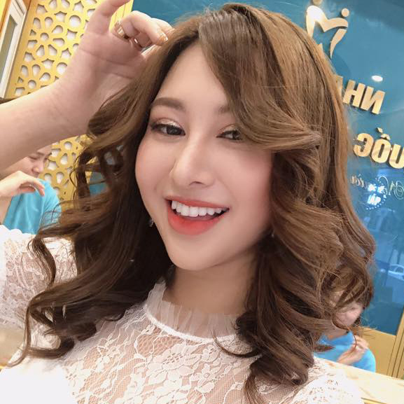 Răng Sứ HT Smile Là Gì? Những Ưu Điểm Vượt Trội